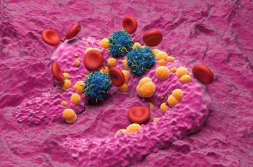 CAR T cell therapy in Basal-cell carcinoma (BCC) - isometric view 3d illustration