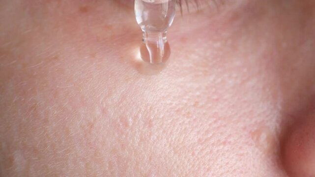 Young woman dispenses dropper of serum on face skin. Lady fingers spread cosmetic across under-eye area ensuring absorbing nourishing benefits