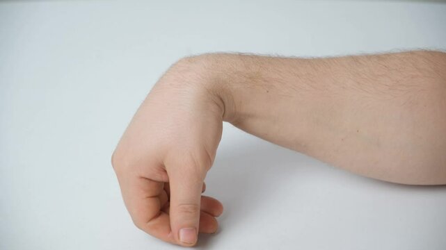 Ganglion cyst or hygroma of the wrist on the hand of a male patient, the process of flexion of the wrist joint.