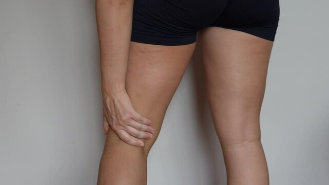 Cropped shot of young woman touching painful popliteal fossa with hand on a light background. Sport injury, sore knee joint. Aching pain in the back of the knee. Popliteal tendinitis. Medical concept