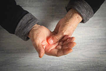 Caucasian elderly woman suffering from finger pain.
