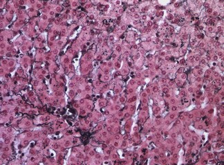 Liver with Gomori argyrophile stain