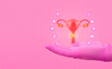 The doctor's hand in a pink glove shows the uterus with cancerous tissue. Isolated on pink background with medicine icons. Cervical cancer concept