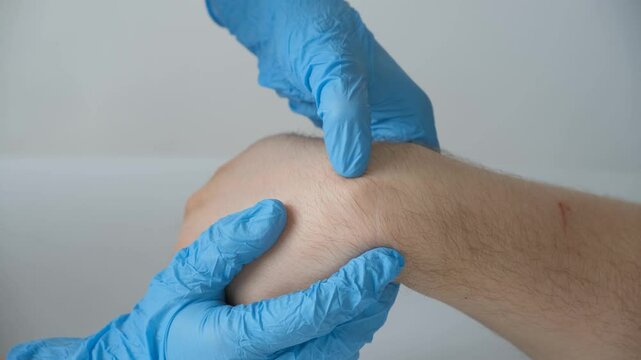 Ganglion cyst or hygroma of the wrist on the hand of a male patient, examination by a doctor.