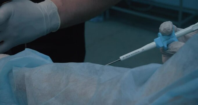 During gastroscopy, the assistant holds endoscopic biopsy forceps in his hand. Close-up of endoscopic biopsy forceps in the hands of a veterinary surgeon. Taking a biopsy during gastroscopy.