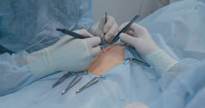 A veterinary surgeon makes an incision on the pet's abdominal wall with an electric scalpel in the operating room. A surgeon operates on an animal in the operating room of a veterinary clinic.
