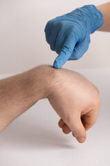 Ganglion cyst or hygroma of the wrist on the hand of a male patient, examination by a doctor