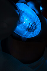 Teeth ultraviolet whitening process. Dentist is whitening teeth of his patient with ultraviolet...