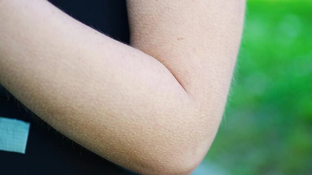 Goosebumps on female arm with summer green background