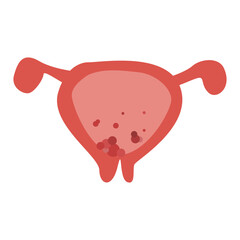 cancer cell. cancer disease concept