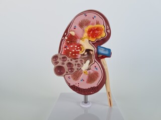 A Detailed Anatomical Model of a Human Kidney