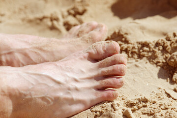 Close-up of feet buried in sand at the beach, highlighting toes with a fusion deformity, depicting relaxation, beach activities, and unique physical traits.