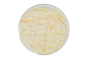 Bacteria. Microbiology. Bacterial colony morphology. Bacterial growth in PCA. Plate Count Agar. Incubated plates. Microbial colonies. Microbial growth. Colony characteristics.