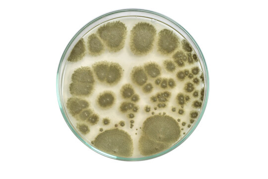 Colony morphology of Yeast and mould. Fungal colony morphology. Fungal growth in DG18. Dichloran Glycerol media. Incubated plates.