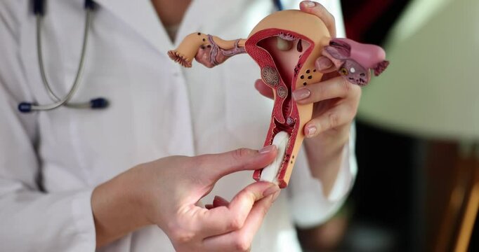 Female doctor inserts tampon into vaginal opening of realistic uterus model. Specialist demonstrates correct use of menstrual hygiene product slow motion