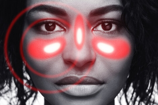 African American woman with symptoms of sinusitis and inflammation of the mucous membrane