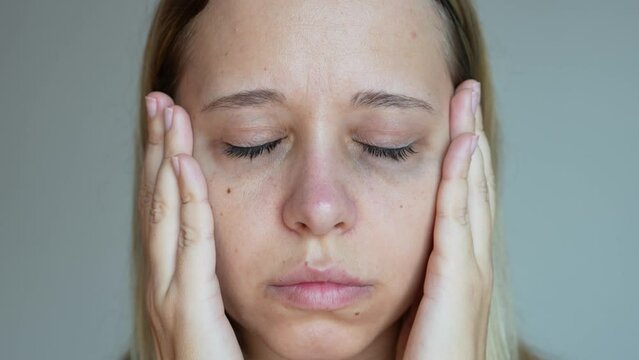 A sad young caucasian woman showing dark circles under her eyes with hand on a dark grey background. Pale skin, bruises under the eyes are caused by fatigue, lack of sleep, insomnia, stress, disease