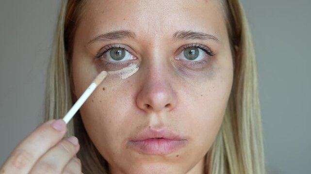 Young caucasian blonde woman applying the mask concealer for dark eyes on a grey background. Bruises, dark circles under her eyes. Foundation cream hiding spot imperfections on female face