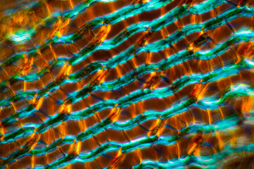 Branch leaf of Sphagnum squarrosum, with polarization at 400x.