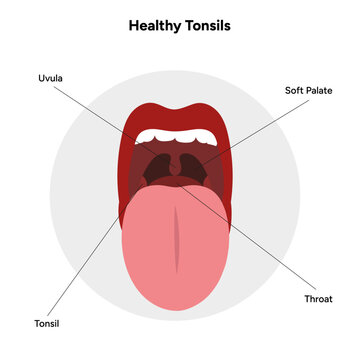 Healthy tonsils medical diagram 