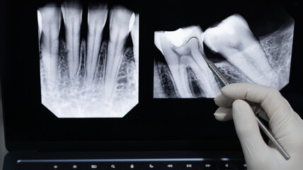 Dentist Examining Dental X-Rays on a laptop