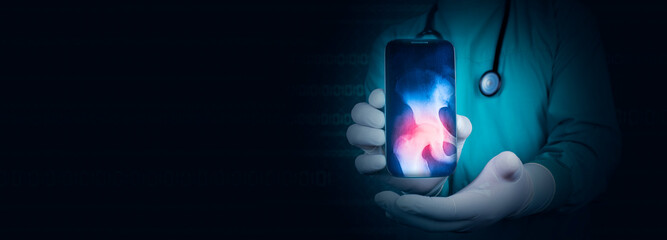 The doctor shows an x-ray of the pelvis, via his cell phone, telemedicine concept. Pain and...