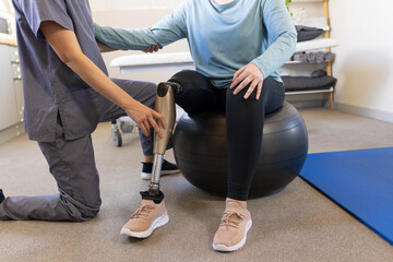 Physical therapist adjusting prosthetic leg for patient sitting on exercise ball