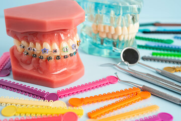 Orthodontic ligatures rings and ties, elastic rubber bands on orthodontic braces, model for dentist...