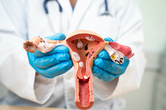 Uterus, doctor with anatomy model for study diagnosis and treatment in hospital.
