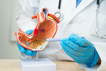 Dyspepsia or gastric disease, doctor holding stomach anatomy model for study  diagnosis and...