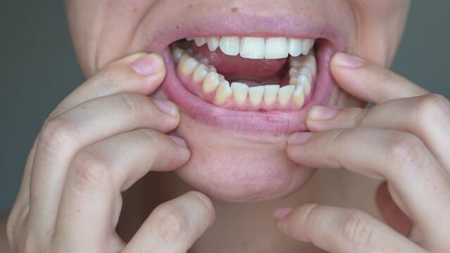 Cropped shot of a young caucasian woman demonstrating her ragged teeth on a dark grey background. Dental health care. Dentistry. Female uneven lower teeth