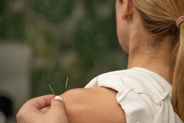 Acupuncture treatment for chronic shoulder pain