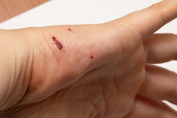close-up of a minor cut on the back of a hand