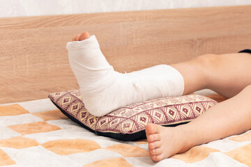 Children's legs, one leg is broken and in a cast