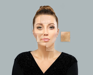 Effects of ageing ,Nasolabial folds,Neck ,Under eye circles,neck lines. Plastic Surgery Results