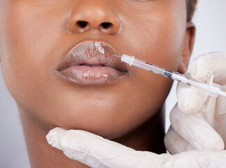 Black woman, collagen and injection for lip filler, cosmetics and beauty on face with hyaluronic...