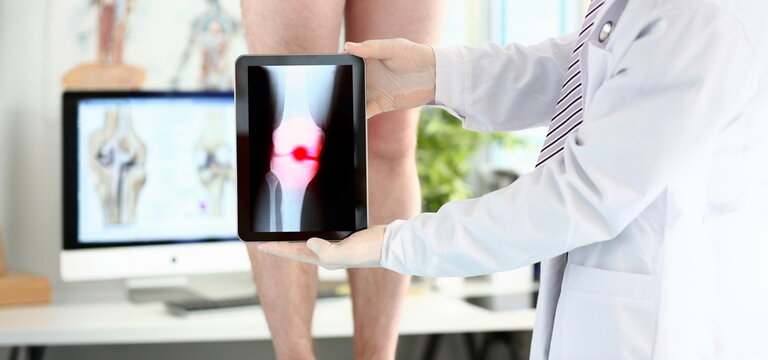 Male physician hands holding tablet computer showing xray shot with paintful area closeup