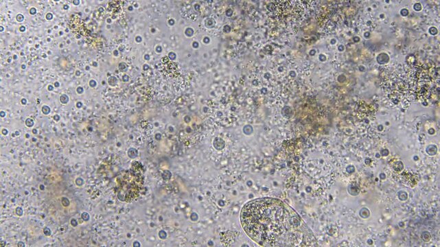 Life in a water droplet under a microscope, showing bacteria, microorganisms, and plants. High magnification reveals paramecia and bacteria. Laboratory study of organic water contamination.