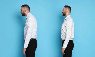 Man with poor and good posture on light blue background. Collage of photos