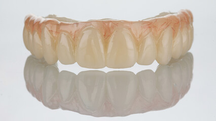 temporary dental prosthesis of the upper jaw on a white background © Dental Pro Content