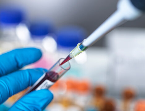 Blood testing