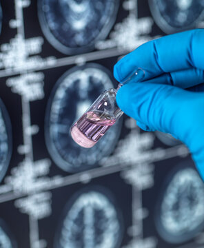 Neurology research, conceptual image