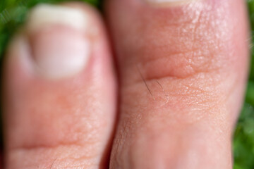 Black toe hairs coming out of the skin in detail