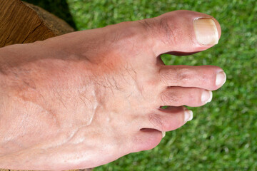 Set of the 5 toes of the right foot of a human being on a green background
