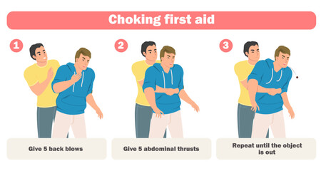 Choking first aid infographic poster with adults rescue emergency help. Stages of heimlich maneuver procedure, right position and abdominal thrusts actions instruction vector illustration