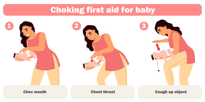 Choking first aid for baby infographic for mother education vector illustration. Heimlich maneuver rescue technique with correct subsequence for unblock infant kid breathing