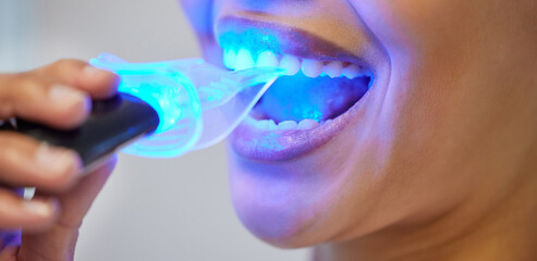 Teeth whitening, LED tool and mouth of person, clinic and treatment in office of dentist and...
