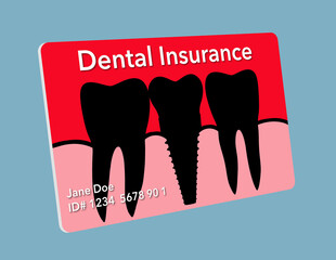 A generic dental insurance card is seen with a design that features a dental implant. This is a 3-d illustration