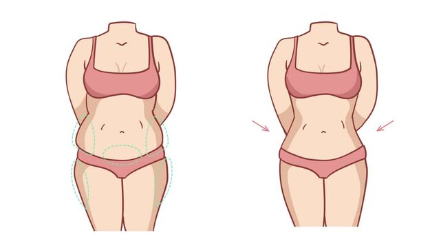 Female Body liposuction fitness slim body fat. fat body to slim body transformation. 4k cartoon animation white background