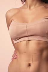 A woman's midsection in beige underwear with surgical marks, ready for cosmetic procedure